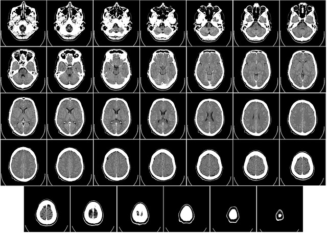 imágenes de exploración médica